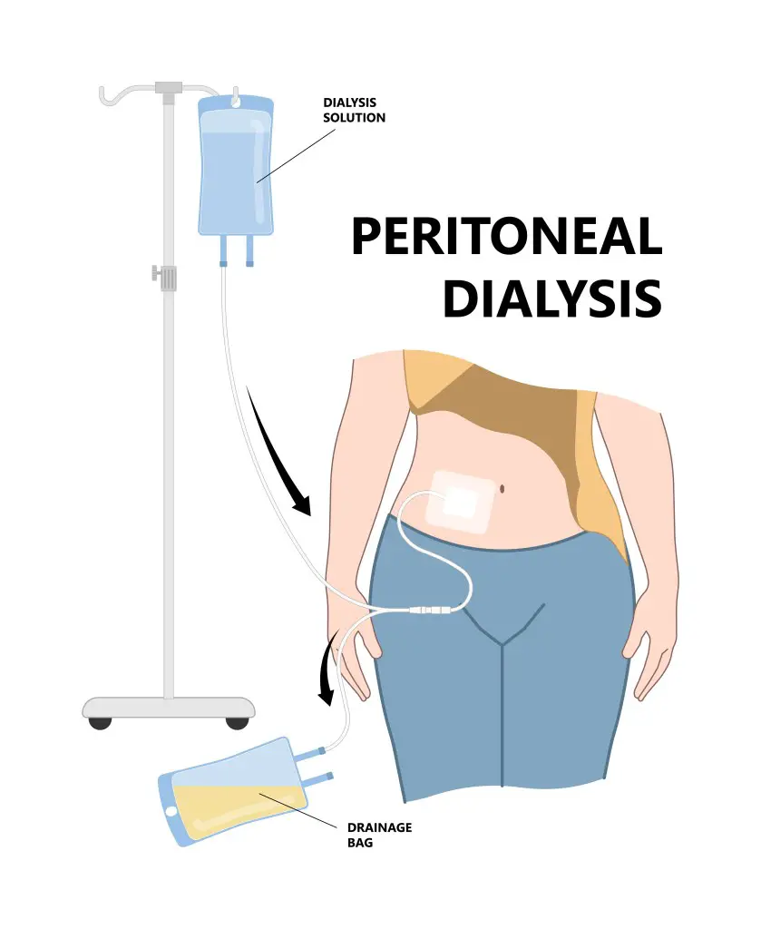 NCLEX Renal Questions